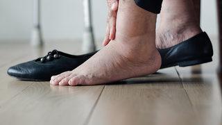 Çorap izlerinize dikkat! En büyük belirtiler arasında yer alıyor