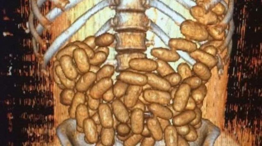 Kilolarca Uyuşturuyu Yutmuşlar