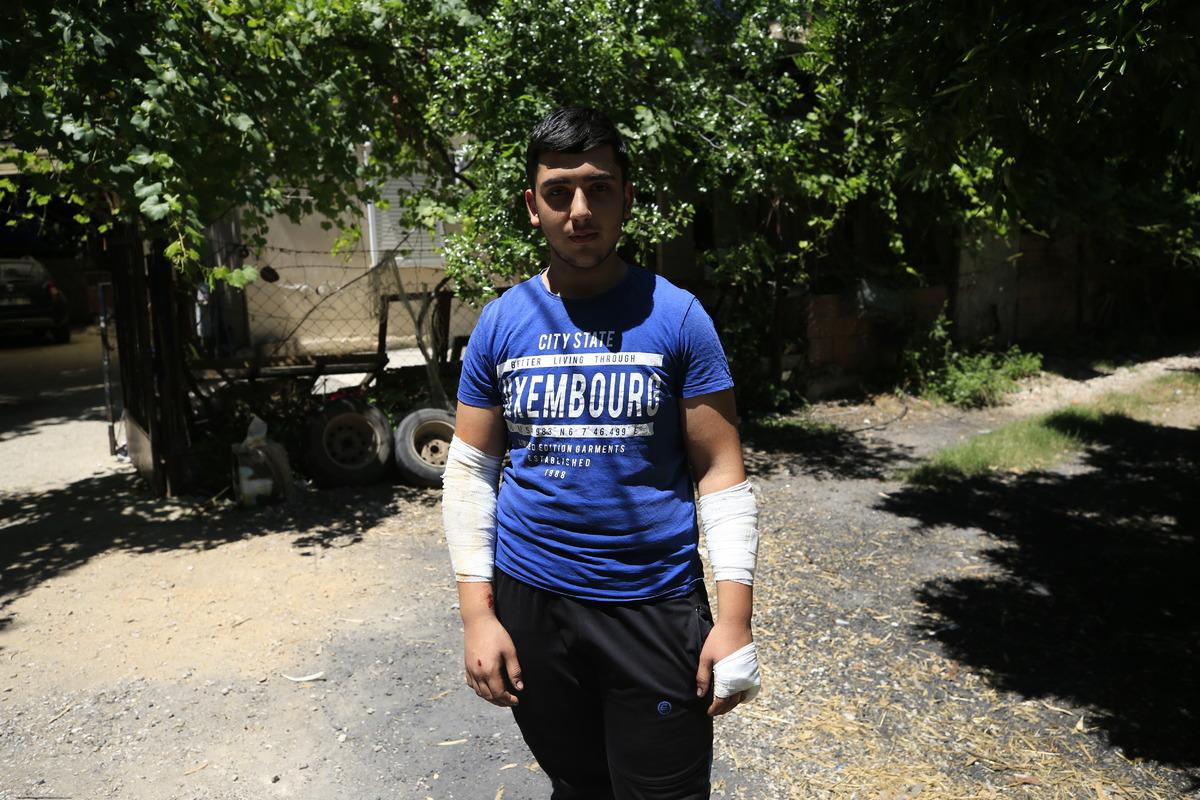 Antalya'da sahipsiz k&ouml;peklerin saldırdığı &ccedil;ocuk yaralandı