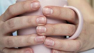 Tırnaklarınız sağlığınız hakkında uyarıyor! Erken teşhis için...