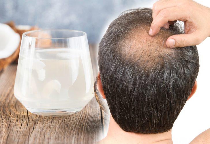 Saç dökülmesine karşı tek malzemeyle etkili çözüm