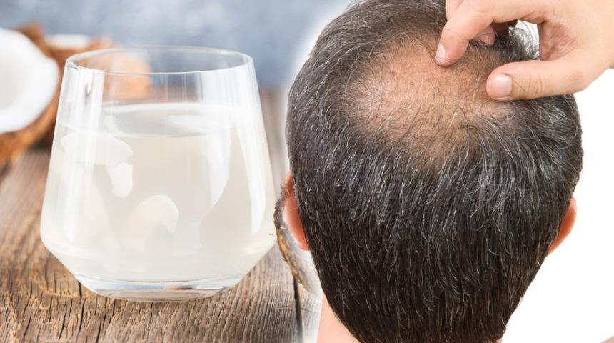 Saç dökülmesine karşı tek malzemeyle etkili çözüm