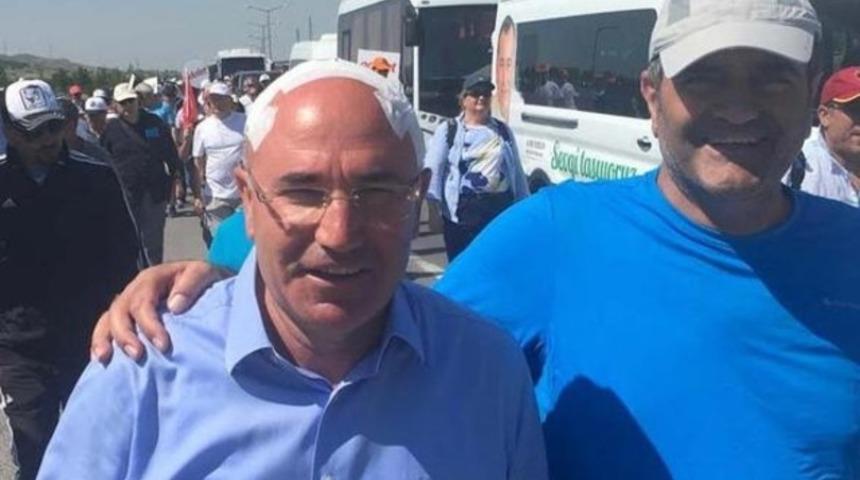 Adalet Yürüyüşü'nde görünmez kaza: Vekil başını çarptı