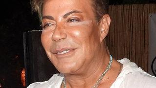 Fatih Ürek'i korkutan kaza! 