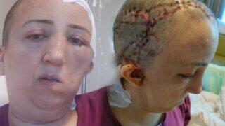 Giresunlu hemşirenin kafatası kemiği kayboldu! Valilik ve belediye harekete geçti