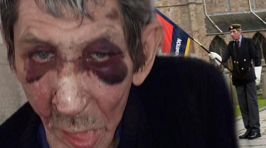 Kanseri üç kez yenmişti, evine giren iki kişi tarafından dehşeti yaşadı