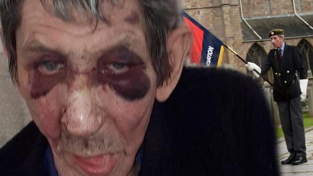 Kanseri üç kez yenmişti, evine giren iki kişi tarafından dehşeti yaşadı