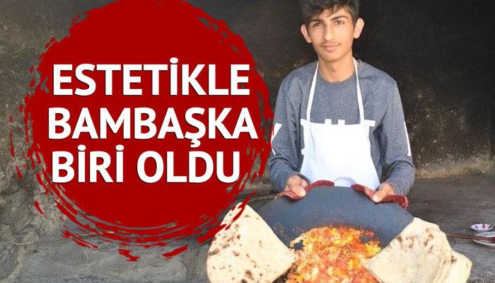 Yemek videoları ile dikkat çeken sosyal medya fenomeni Taha Duymaz estetikle bambaşka biri oldu