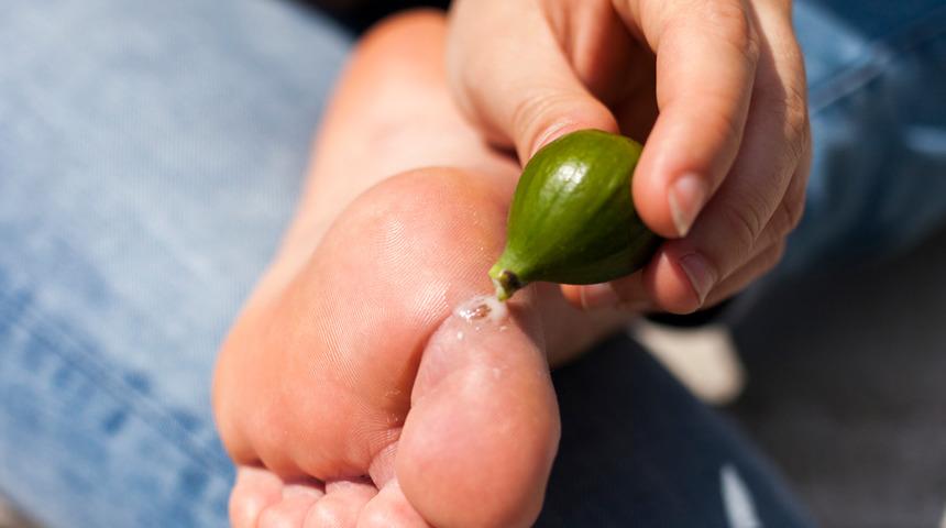 Siğili olan herkes bu hatayı mutlaka yaptı! Uzmanlardan incir egzaması uyarısı