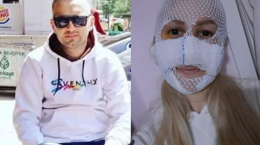 Silahla alıkoyup eski sevgilisinin yüzüne kimyasal madde atmıştı! Cezası belli oldu... Duruşmada şok sözler "Mahkemeyi etkilemek için takıyor"