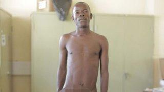 Sinek ısırığı penisini bu hale getirdi! 90 santim 5 kilo