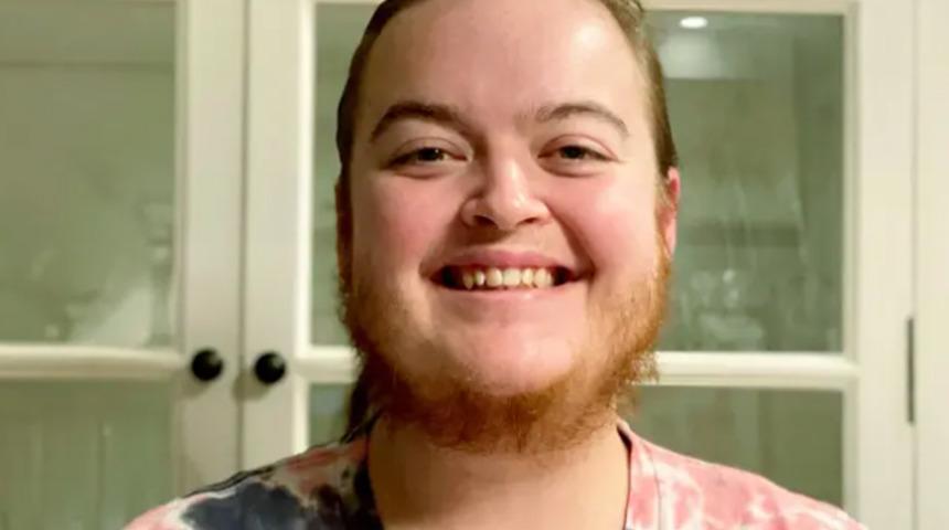 Gen&ccedil; kadının hastalığı nedeniyle &ccedil;ıkan sakalları hayatını değiştirdi