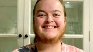 Genç kadının hastalığı nedeniyle çıkan sakalları hayatını değiştirdi