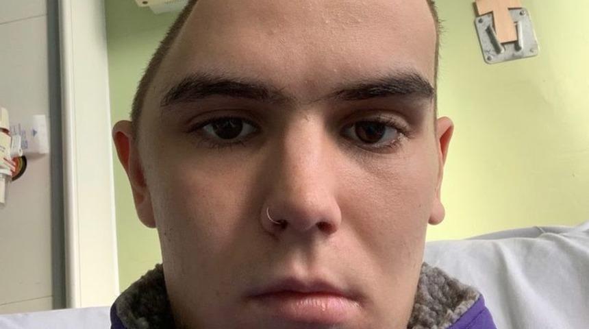 Yaşadığı kaza sonucunda kafatasının bir kısmını kaybetti! “Beynimi sadece deri koruyor”