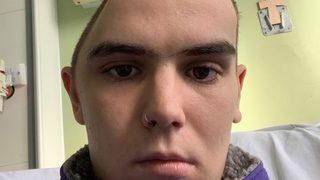 Yaşadığı kaza sonucunda kafatasının bir kısmını kaybetti! “Beynimi sadece deri koruyor”