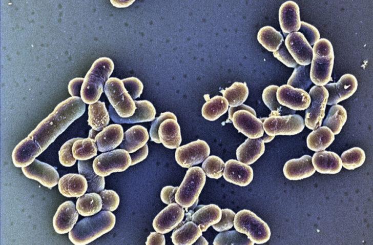 Amerika'da 10 farklı eyalette korkutan Listeria salgını! Dondurmadan bulaştı