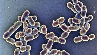 Amerika'da 10 farklı eyalette korkutan Listeria salgını! Dondurmadan bulaştı