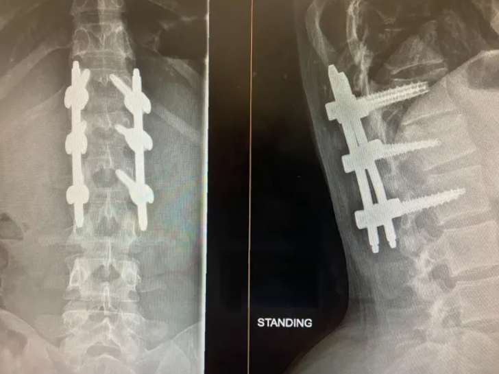 Dehşet anları kamerada! 22 yaşındaki kadın 15 metreden suya atladı, hayatı bir anda değişti G4