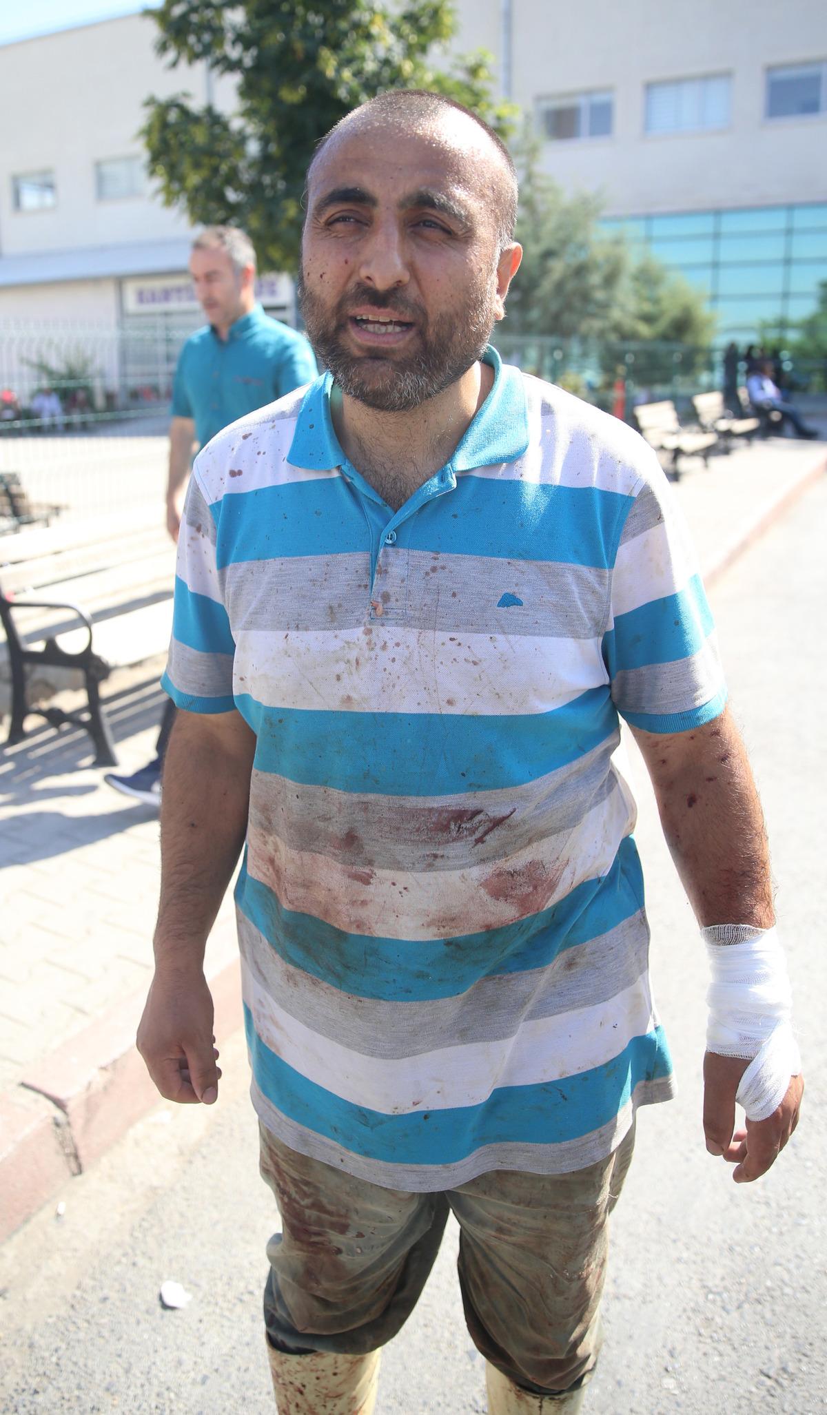 Gaziantep, Kahramanmaraş, Malatya ve Adıyaman'da "acemi kasaplar" hastanelik oldu