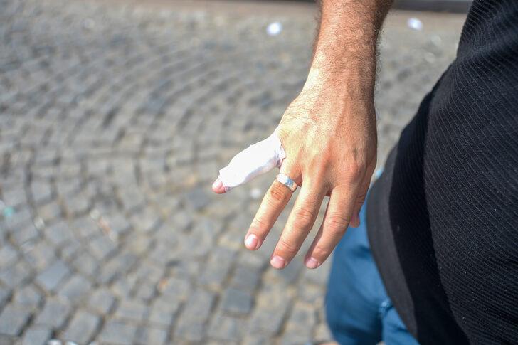 Antalya, Muğla ve Burdur'da "acemi kasaplar" hastanelik oldu G3