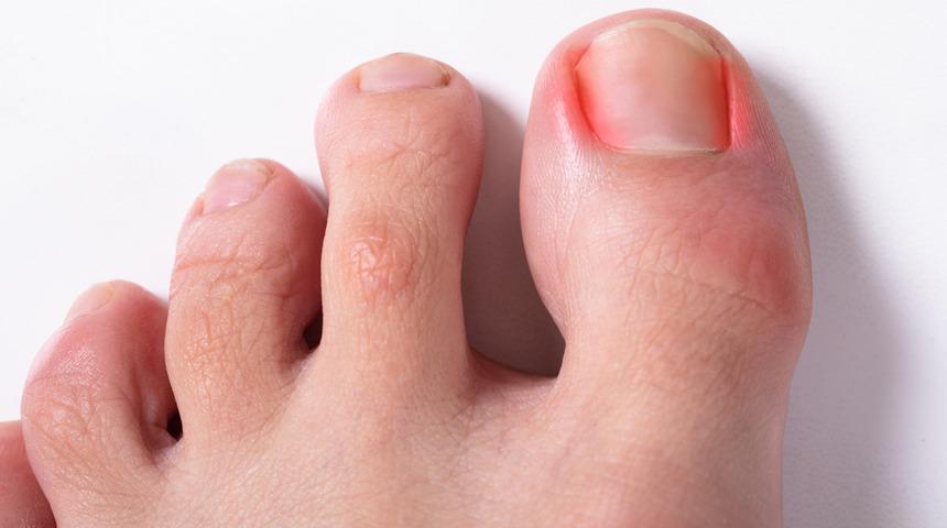 Ayak tırnaklarındaki gizli tehlike: Fark ettiğinizde çok geç olabilir! Kalp krizi ve felç riski