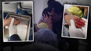 4 yaşındaki Tuğra bayramda dehşeti yaşadı! Elini kıyma makinesi kaptırınca...