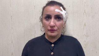 5 günlük bebeğini başka bir aileye sattı! “Burun ameliyatım için paraya ihtiyacım vardı”