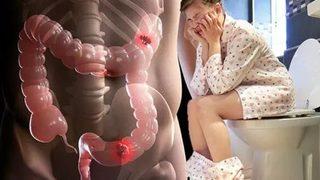 Tuvalette zorlanıyorsanız... Ölümcül belirtilere dikkat!