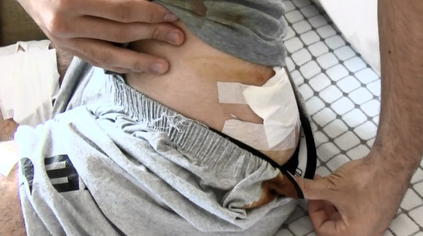 14 yaşındaki çocuğa bıçaklı, kemerli, yumruklu saldırı! Babası izleyemedi: Yüreğim el vermedi