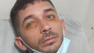 Yemek yediği sırada cep telefonu bomba gibi patladı! Parçası gözüne saplanan genç neye uğradığını şaşırdı