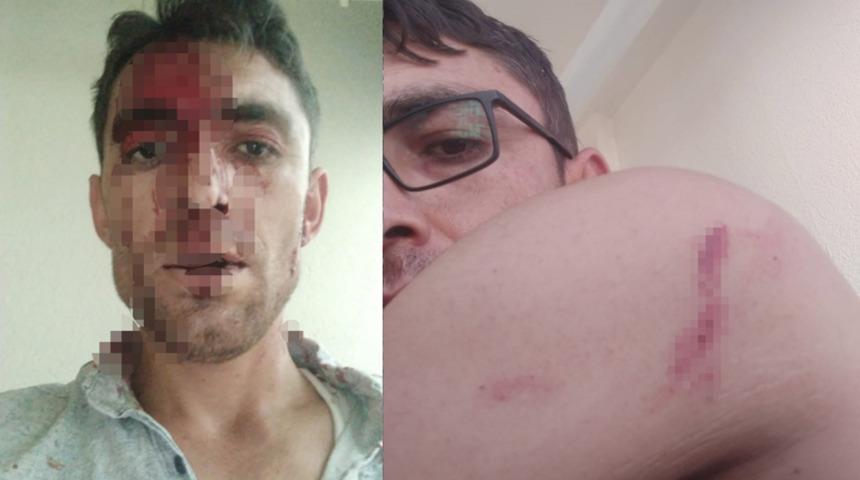 Nevşehir'de komşu dehşeti! Kulak memesi koparıldı, kafasına dikiş atıldı