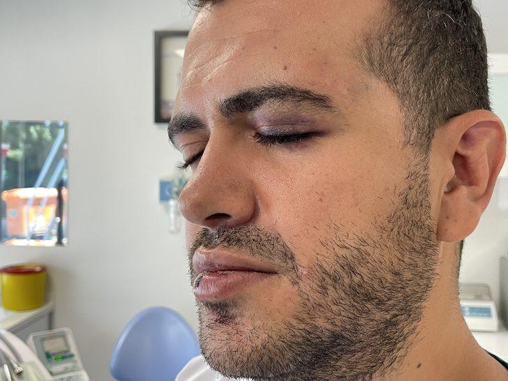 Gaziantep'te diş hekimi meslektaşının kendisini darbettiği iddiasıyla şikayetçi oldu G2