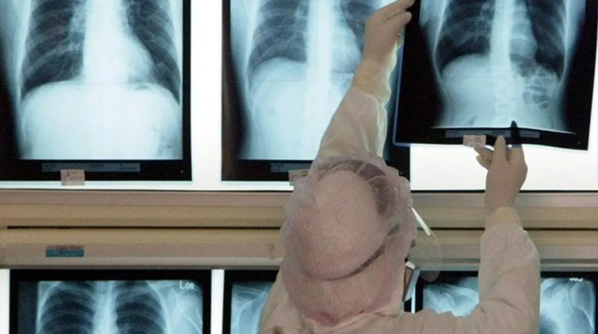 Tam 3 gün boyunca tuvaletini yapamadı! Makatından 12 santimetrelik pet şişe çıktı