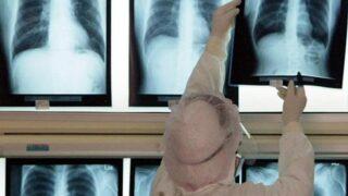 Tam 3 gün boyunca tuvaletini yapamadı! Makatından 12 santimetrelik pet şişe çıktı