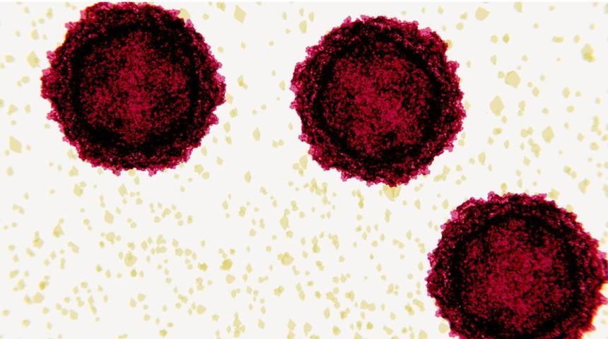 Londra'da çocuk felci virüsü görüldü: Çocuk felci nedir ve nasıl yayılır?