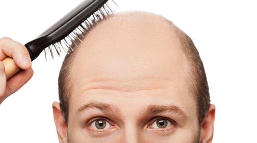 Sa&ccedil; ekiminde etkin &ccedil;&ouml;z&uuml;mler: Fue ve Perkutan y&ouml;ntemi