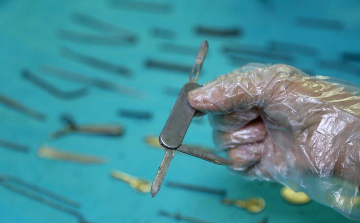Van'da kadın hastanın midesinden 158 yabancı cisim çıkarıldı G4