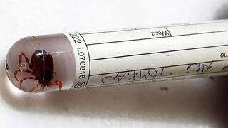 Adana'da kene ısırığı can aldı! Polis memuru hayatını kaybetti