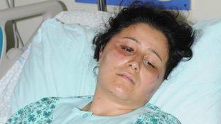 Eşini keser ve çekiçle döverek hastanelik etti