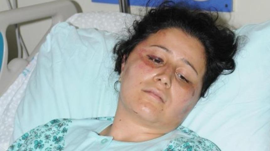 Eşini keser ve çekiçle döverek hastanelik etti