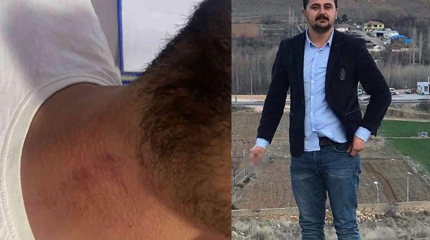 CHP ilçe gençlik kolları başkanını, "biz seni görevden aldık" diyerek darp etti