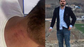 CHP ilçe gençlik kolları başkanını, biz seni görevden aldık diyerek darp etti