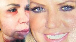 Doktor sahte çıktı! İstanbul'da estetik faciası, tanınmaz hale geldi