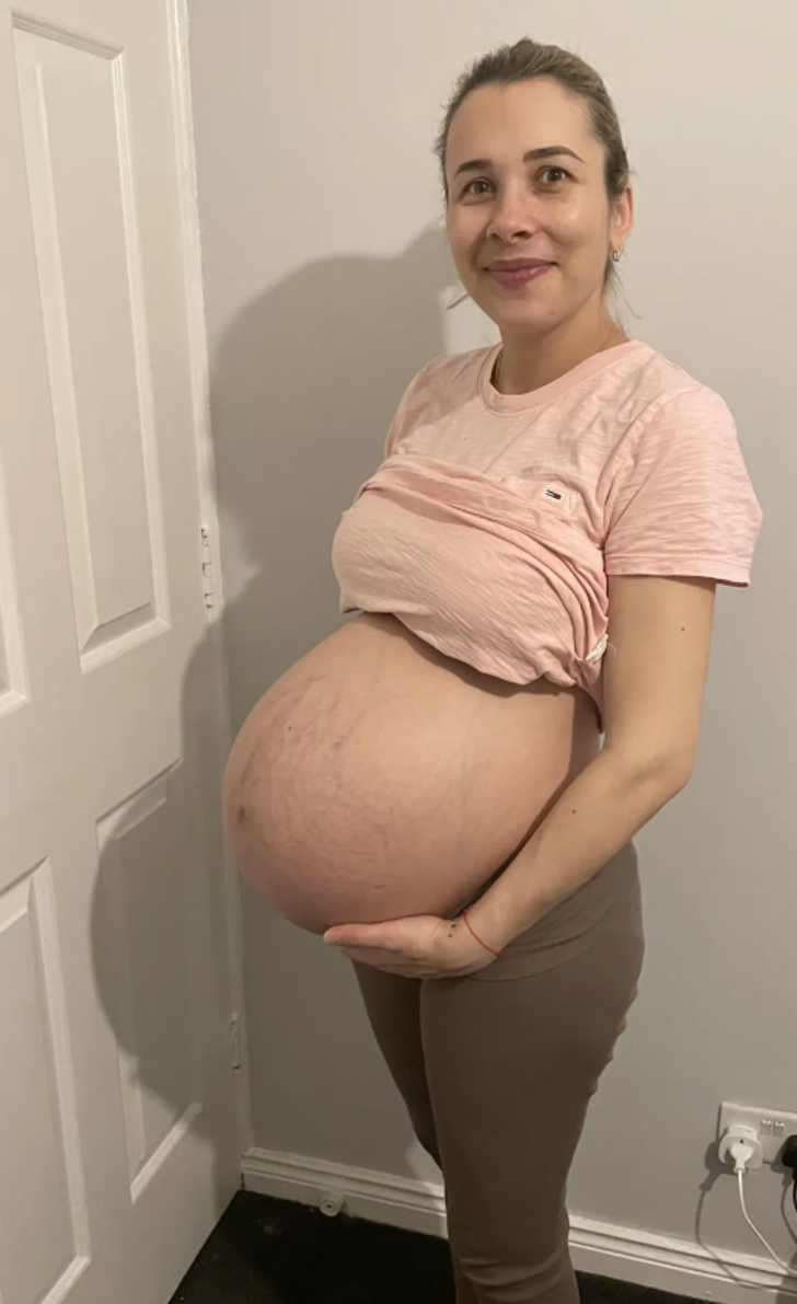 Doktorlar söyleyince inanamadı! “Bir haftada iki kez hamile kaldım”