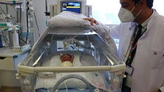 Tekirdağ'da 23 haftalık doğan bebeğe kök hücre nakli yapıldı