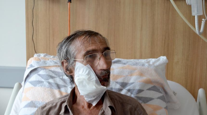 Trabzon'da, ağzındaki tümör nedeniyle su bile yutamayan hasta sağlığına kavuşturuldu