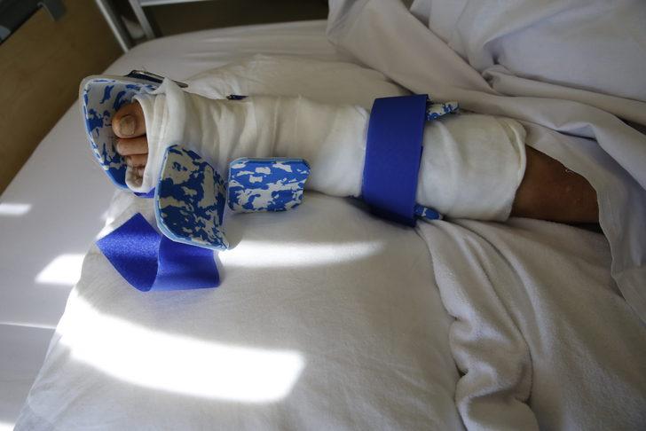 Samsun'da 10 yaşındaki çocuğun kopan ayağı yerine dikildi G2