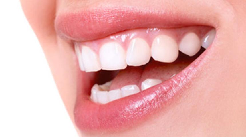 Dişeti İltihabı Nedir?