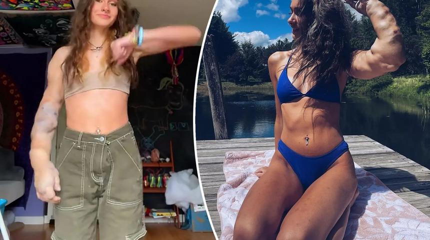 Devasa bir kolla doğdu! ''İnsanlar kesmemi söylüyor''