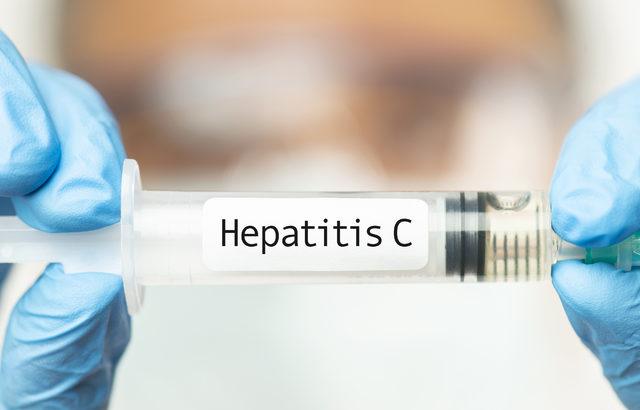 hepatit c